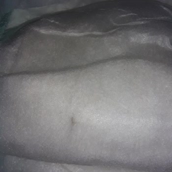 BİM Bebek Bezinde Sert Bir Cisim Çıktı