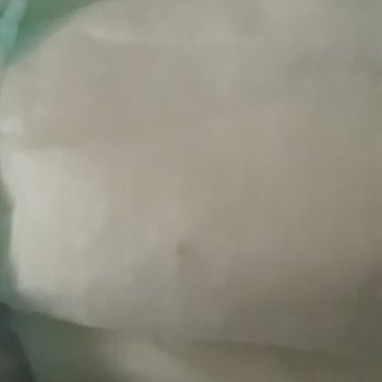 BİM Bebek Bezinde Sert Bir Cisim Çıktı