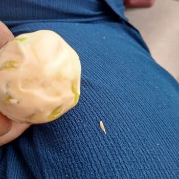 BİM Dudi Dondurmadan Tırnak Çıktı