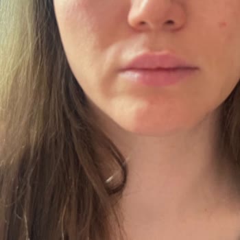 Prof. Dr. Altuğ Çetinkaya Estetik Uygulamalarda Yaşanan Sorunlar