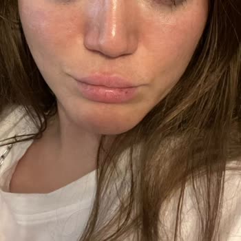 Prof. Dr. Altuğ Çetinkaya Estetik Uygulamalarda Yaşanan Sorunlar