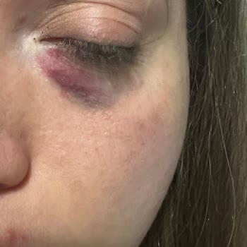 Prof. Dr. Altuğ Çetinkaya Estetik Uygulamalarda Yaşanan Sorunlar