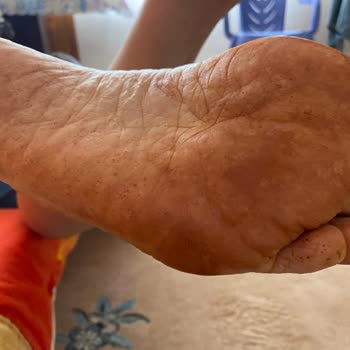 Polaris Mağazadan Alınan Ürün Sorunları