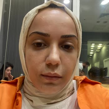 Estpoint Estelift Şikayet Var