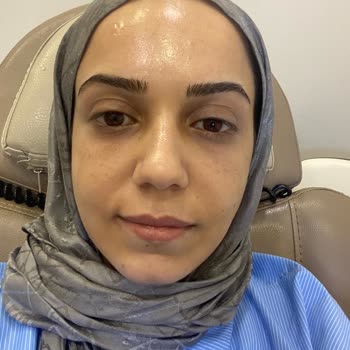 Estpoint Estelift Şikayet Var