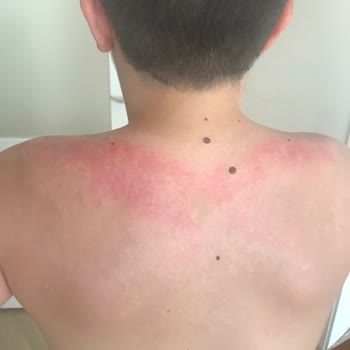 Nivea Marka Krem Pişmanlığı