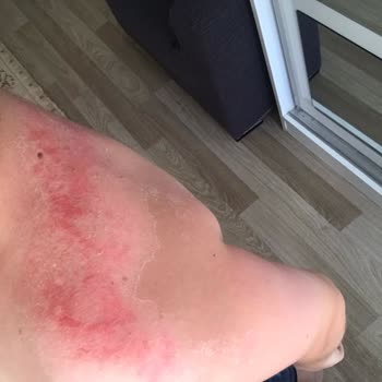 Nivea Marka Krem Pişmanlığı