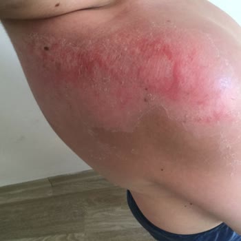 Nivea Marka Krem Pişmanlığı