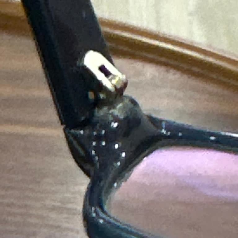 Atasun Optik Bir Vida İçin Gözlüğümü Kırdılar