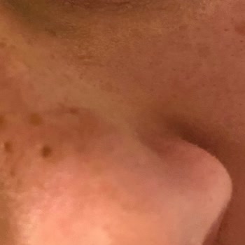 Yves Rocher Güneş Kremi Yüzünden Mağdurum