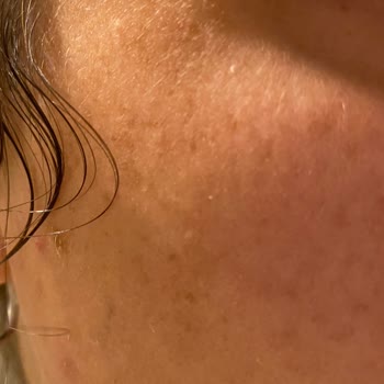 Yves Rocher Güneş Kremi Yüzünden Mağdurum