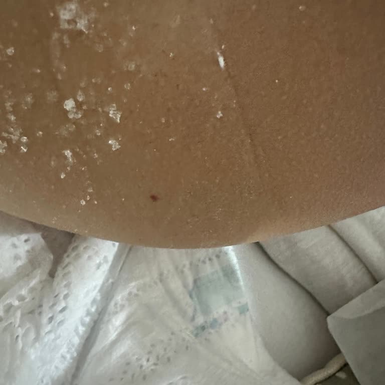 Prima Bebek Bezi Kristalleşme Sorunu