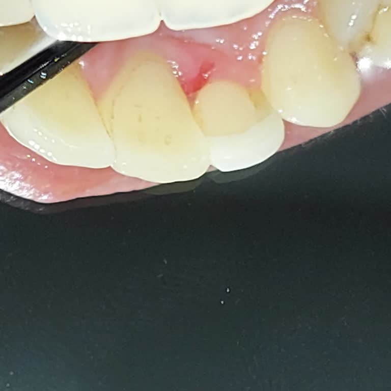 Dentolya Diş Sağlığı Merkezi Dentolya Da Yaşadığım Hayal Kırıklığı Ve Pişmanlık...