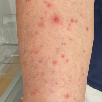 Gold Island Hotel Ve ETS Tur Memnuniyetsizliği