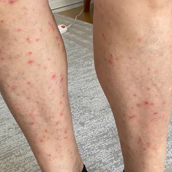 Gold Island Hotel Ve ETS Tur Memnuniyetsizliği