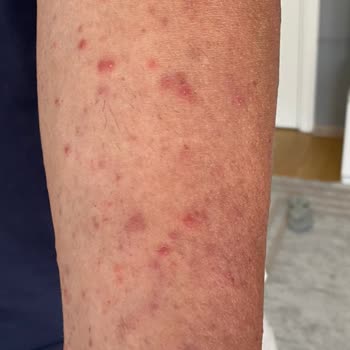 Gold Island Hotel Ve ETS Tur Memnuniyetsizliği