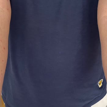 Gold Island Hotel Ve ETS Tur Memnuniyetsizliği