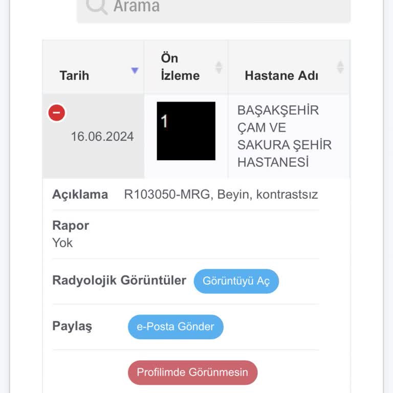 Başakşehir Çam ve Sakura Şehir Hastanesi Hastane Sonuçları E Nabız Da Çıkmıyor