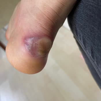 Puma Ayağımı Maaf Etti