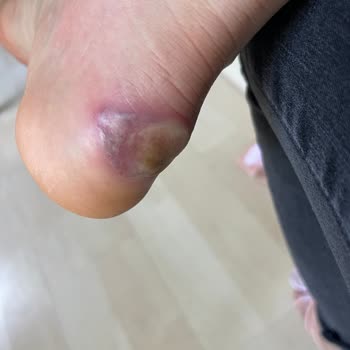 Puma Ayağımı Maaf Etti