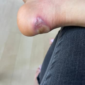 Puma Ayağımı Maaf Etti