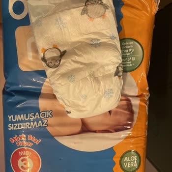 Ebebek BabyMe Bebek Bezi Üretim Hatası Ve Firmanın Yaklaşımı