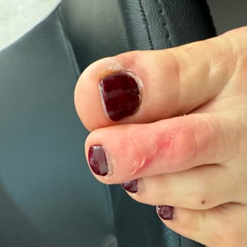 Tommy Hilfiger Kalitesiz Ayakkabısını İade Almıyor!