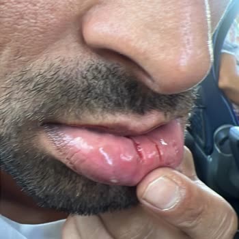 Emniyet Genel Müdürlüğü Kütahya'da Polisler Tarafından Mağdur Edildik!