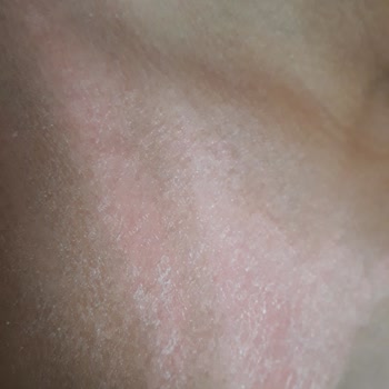 Bioxcin Güneş Kremi Çocuklar İçin Yetersiz Koruma Sağladı