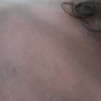 Bioxcin Güneş Kremi Çocuklar İçin Yetersiz Koruma Sağladı