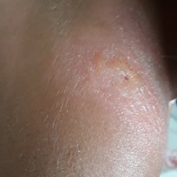 Bioxcin Güneş Kremi Çocuklar İçin Yetersiz Koruma Sağladı