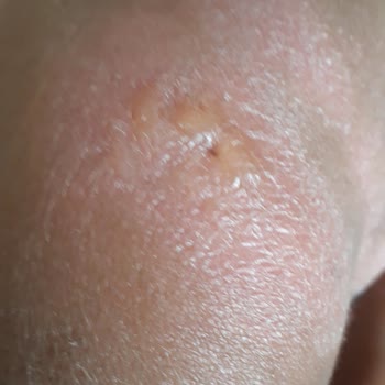 Bioxcin Güneş Kremi Çocuklar İçin Yetersiz Koruma Sağladı