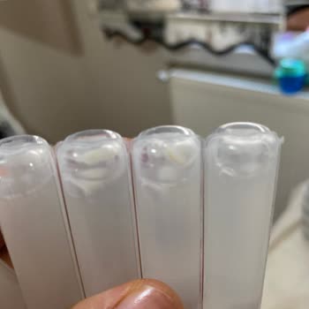 Migros Bozuk Probiyotik Satışı?