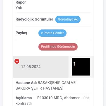 Başakşehir Çam ve Sakura Şehir Hastanesi Başakşehir Cam Ve Sakura MR Çıkmaması