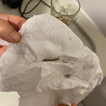 Yedikule Göğüs Hastalıkları Ve Göğüs Cerrahisi Eğitim Ve Araştırma Hastanesi Göğüs Hastalıkları Yedikule