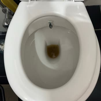 Antalya Büyükşehir Belediyesi Su Gelmezse Kolera Salgını Kaş Bayındırda Başlayabilir!