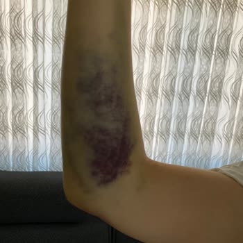 Öztan Hastanesi Uşak'ta Hastane Müdahalesi Sonucu Yaşanan Sağlık Sorunu