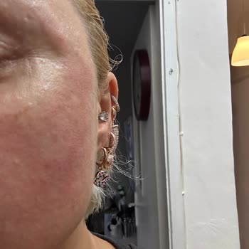 Koreaco Cilt Alerjisi Yapan Ürün Ve Firma Şikayeti