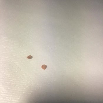 Getir Yemek Ve Dürümden Çıkan Kemik Parçaları