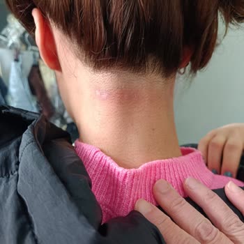 Opia Beauty Lounge İnsanları Mağdur Ediyor.