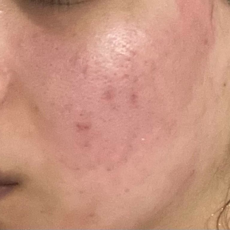 Abdi İbrahim Hametan Pişmanlık Yüzümü Yaktı