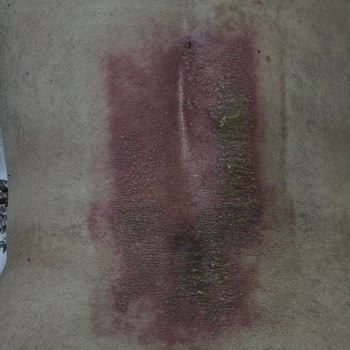 Artçüre Denen Yakı Pişmanlığı