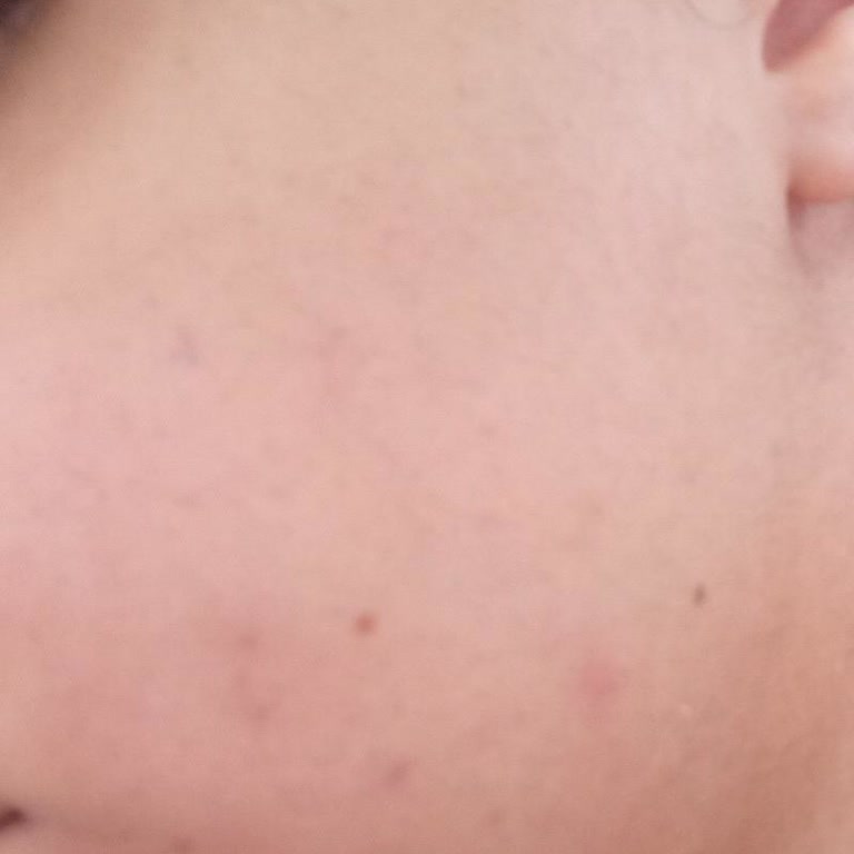 Yves Rocher Yağ Dengeleyici Serum Yüzümü Mahvetti