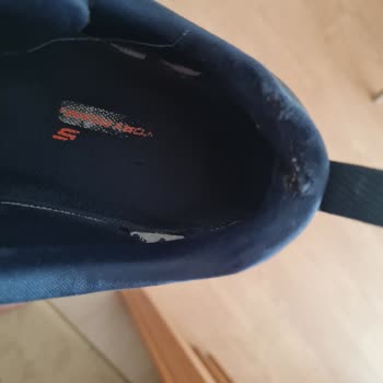 Skechers Ayakkabı Dayanıksızlığı! Skechers Ayakkabıları Pişmanlıktır!