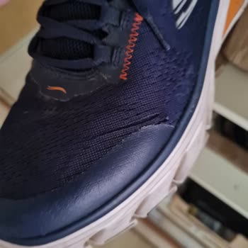 Skechers Ayakkabı Dayanıksızlığı! Skechers Ayakkabıları Pişmanlıktır!