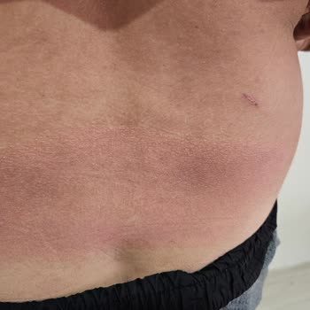 Rizom Tatil Köyü Böcek Ve Temizlik Sorunu