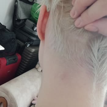 Palette 10.1 Saç Derisini Yakıyor