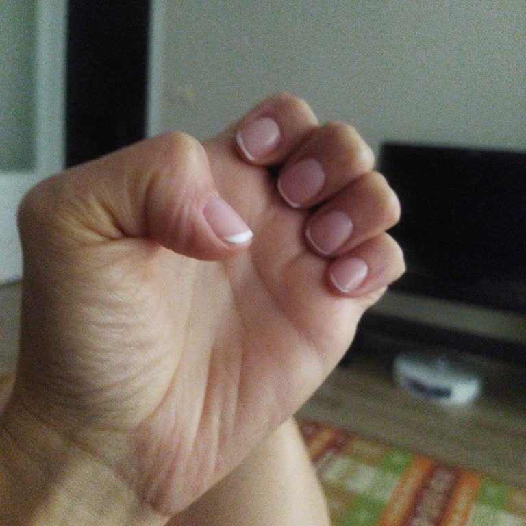 Aris Ezgi Doğan Polikliniği Aris Çukurambar Fazla Para Aldı