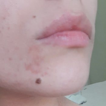 Vi-Vet Ürün Kalitesi Değişmiş