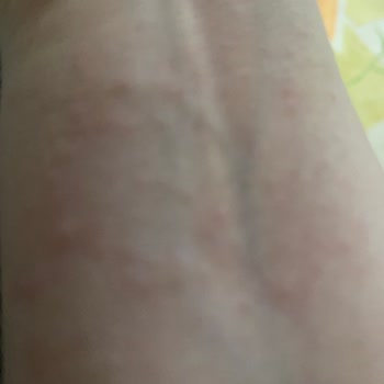 Koton 1 Haftada Rengi Atan Takının İadesini Kabul Etmiyor!